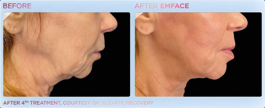 A before and after photo of a woman 's face.