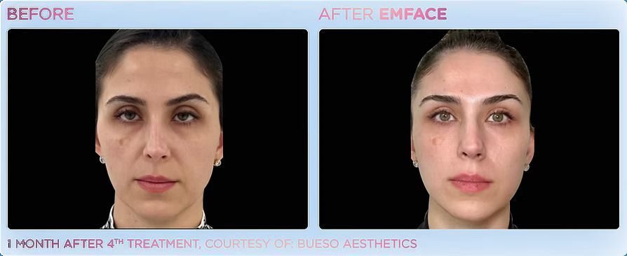 A before and after photo of a woman 's face