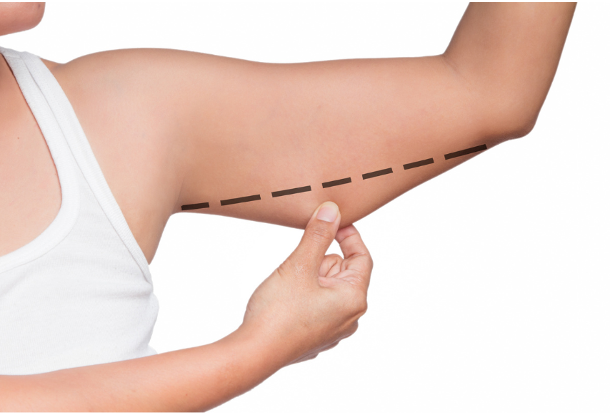 A woman is measuring her arm with a line drawn on it.