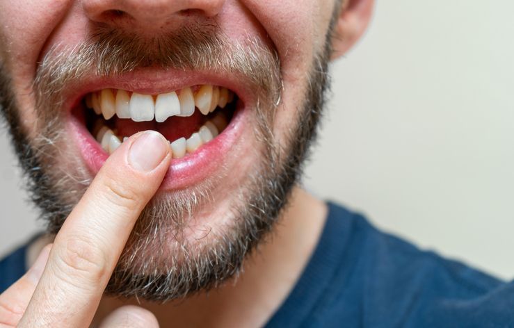 Dentist showing patient dental x-ray on tablet. Light-skinned dentist in blue scrubs points, patient with curly hair.