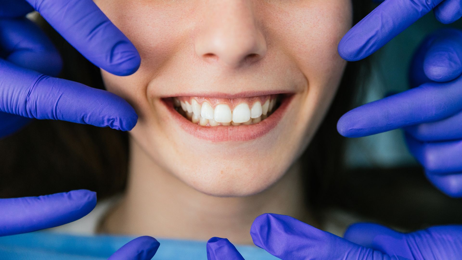 Smiling person's mouth surrounded by hands in blue gloves, likely a dental checkup.