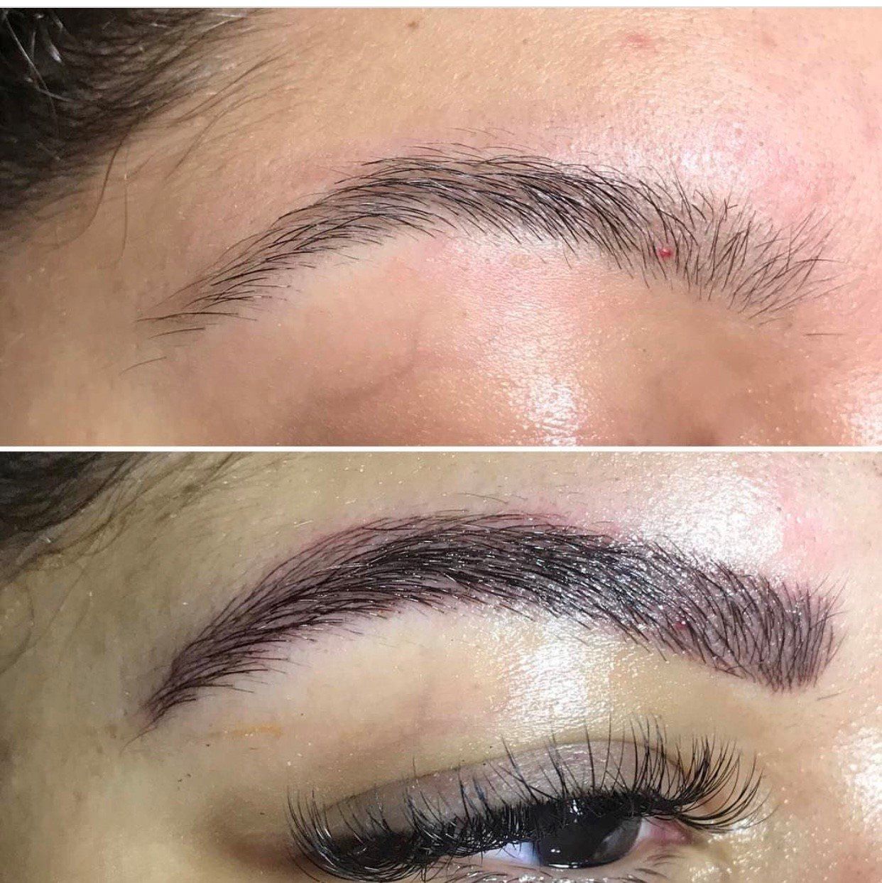 Eyebrow before/after