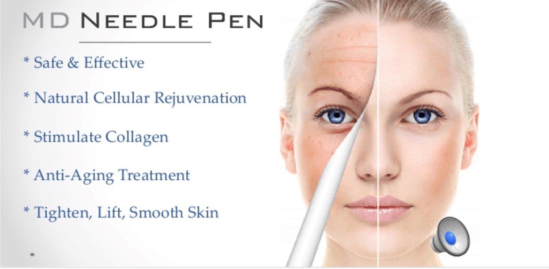 MD needle pen
