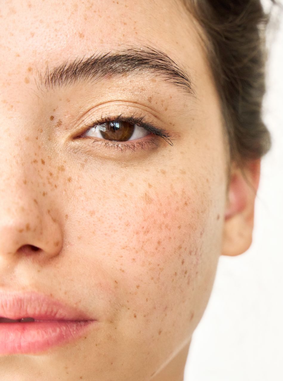 A close up of a woman 's face with freckles and a brown eye.