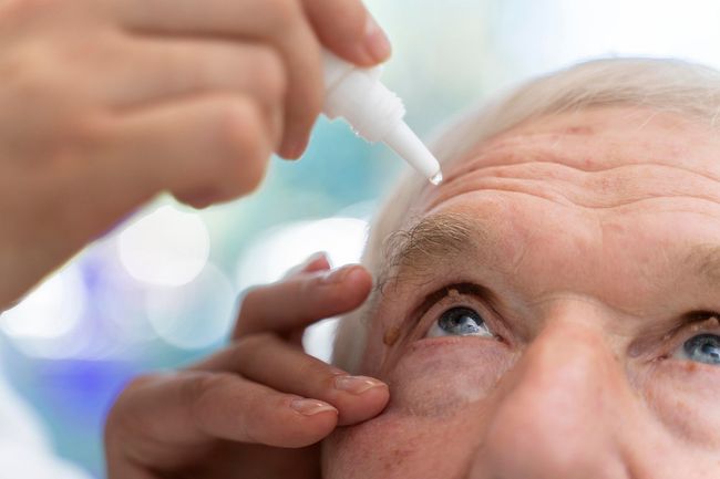 Persona que recibe gotas para los ojos; el primer plano muestra una mano dispensando líquido en el ojo de una persona mayor.