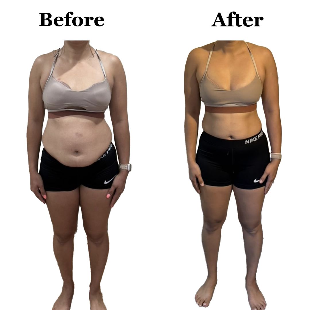 A woman is shown before and after losing weight