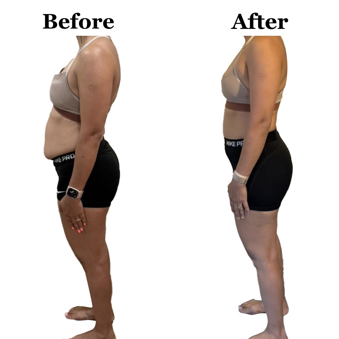 A before and after photo of a woman 's body