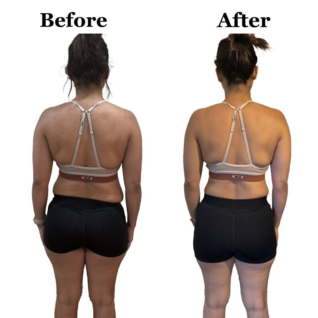 A before and after picture of a woman 's back
