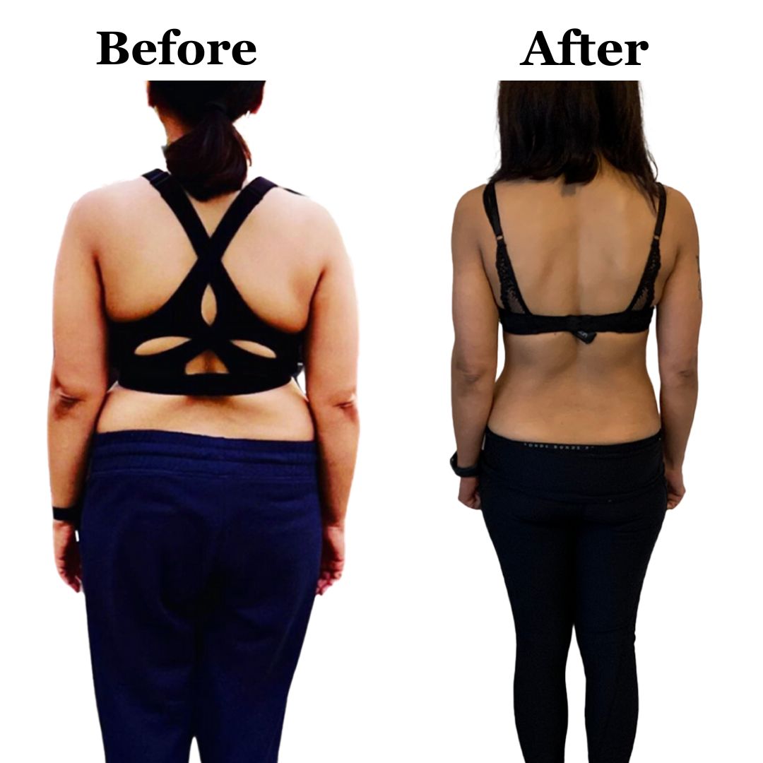 A before and after picture of a woman 's back