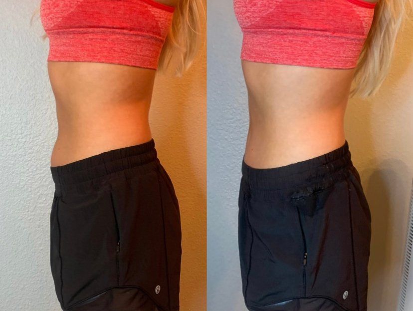 Before and after waist contour of woman wearing red top — Minneapolis, MN — InstaSculpting Body Contour Center