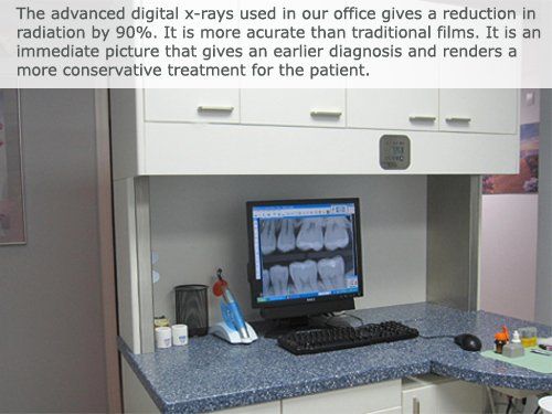 Dental Technology — Advanced Digital X-Rays in Plainville, MA