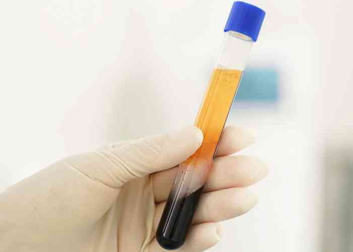 Regenerative Medicine