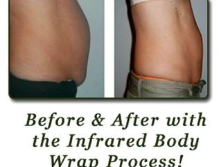 Before and after photo showcasing the effectiveness of Formostar Infrared Wraps at Fit n Tan Salon & Spa St. Louis