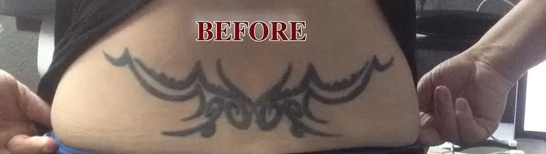 A person has a tattoo on their back that says before