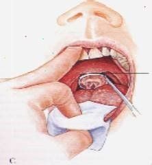 Apparecchiatura otorino 4