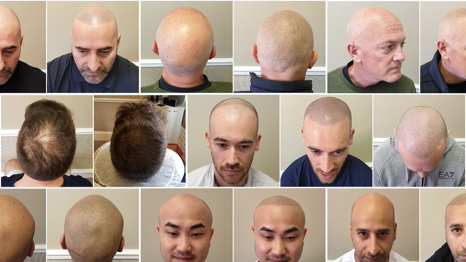 Before and after SMP results for thinning