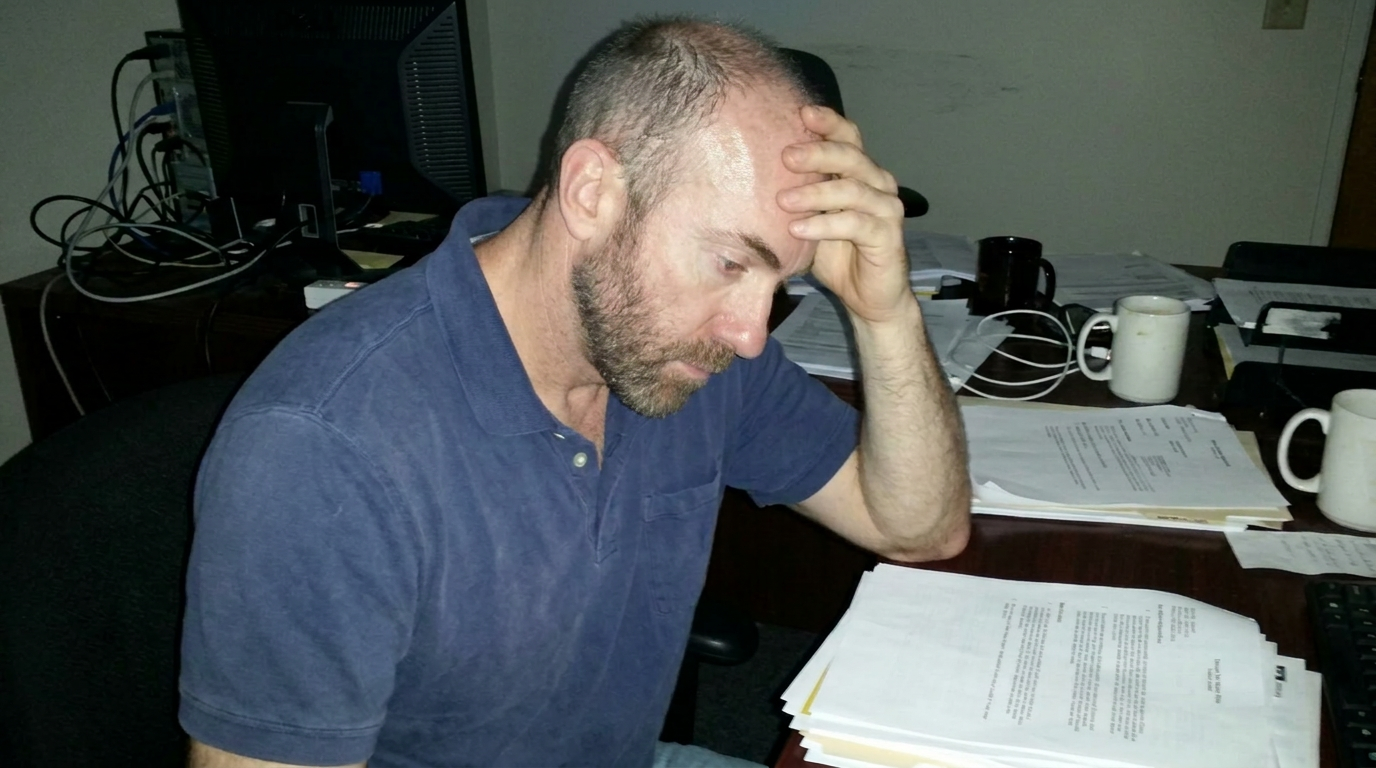 First Signs of Male Balding