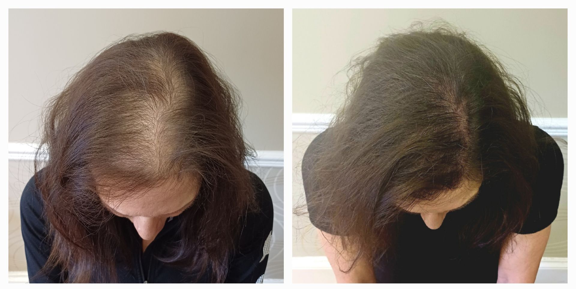 Before and after SMP results for thinning