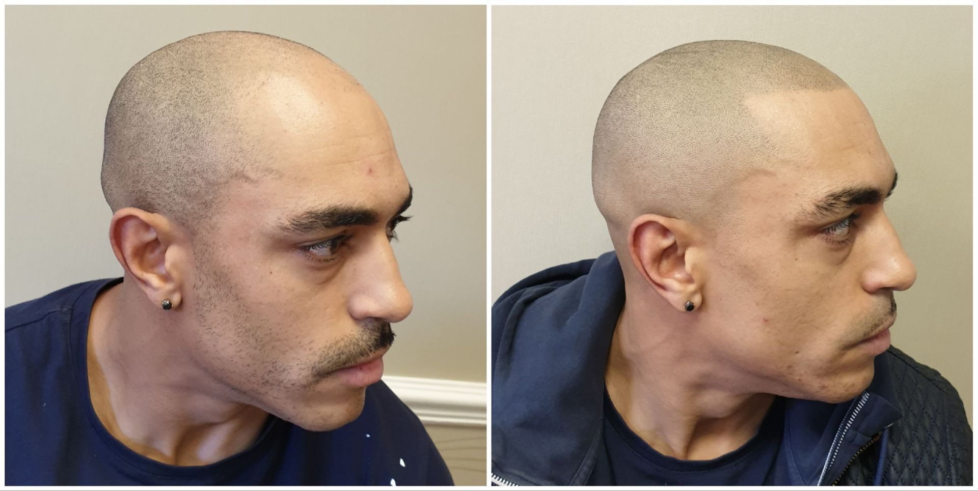 smp results before and after