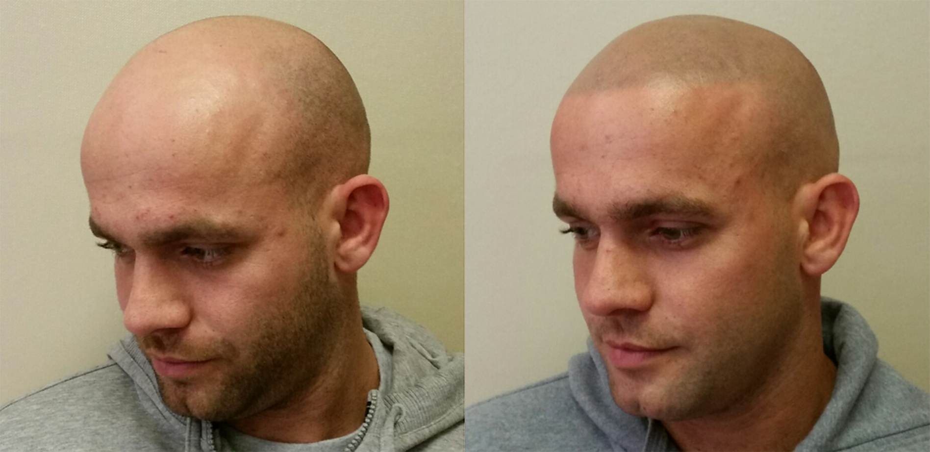 SMP Before and After Results