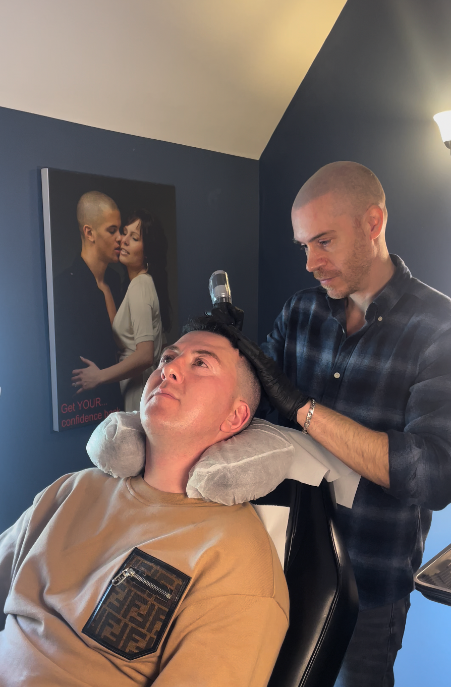 SMP hair transplant combined men