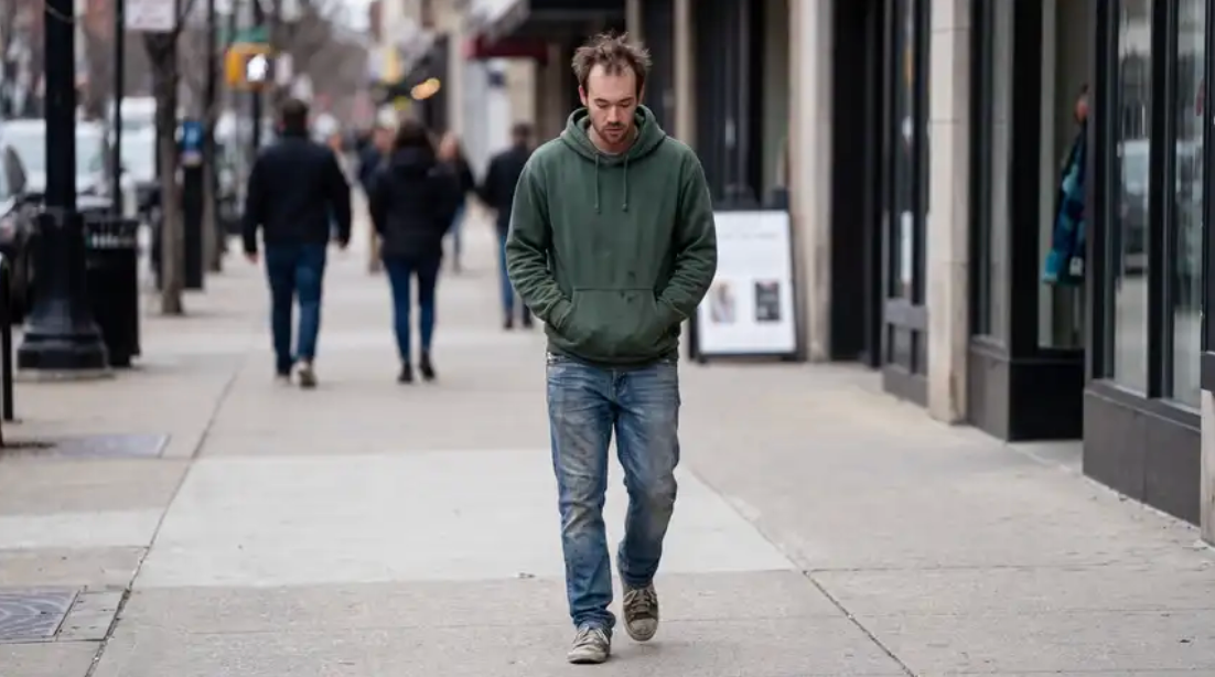 Male Balding Solutions