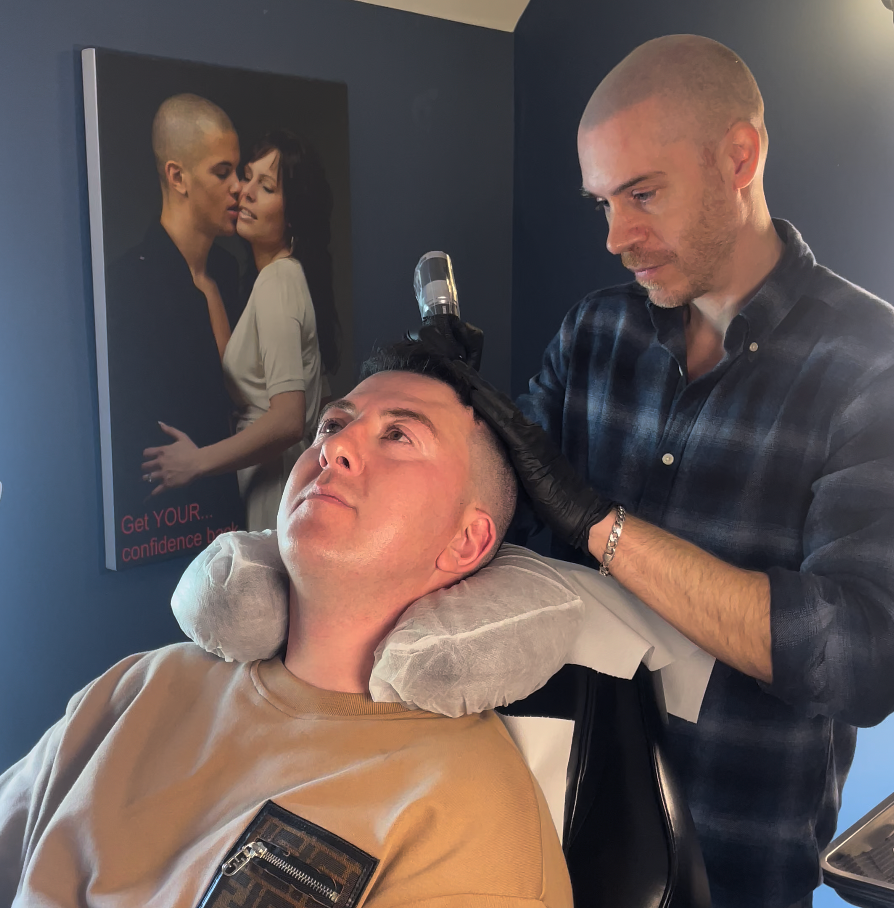 Your Hair Clinic Mens SMP Results on Hair Transplant