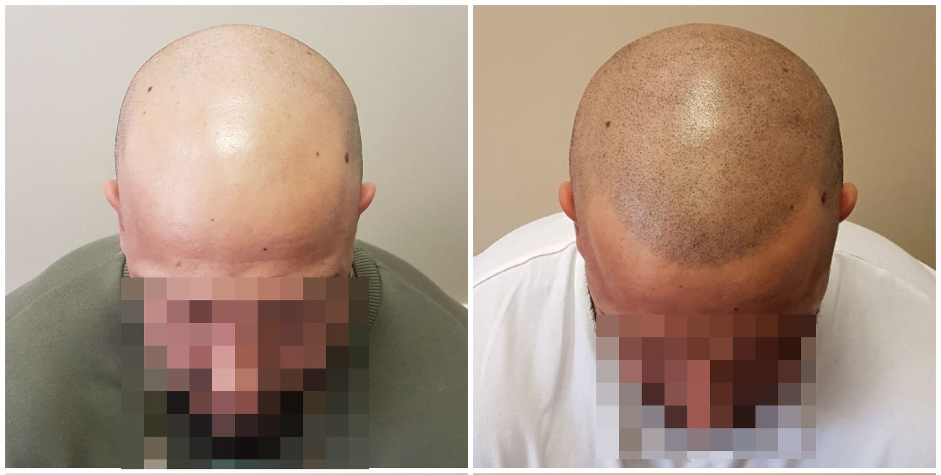 SMP Before and After Results