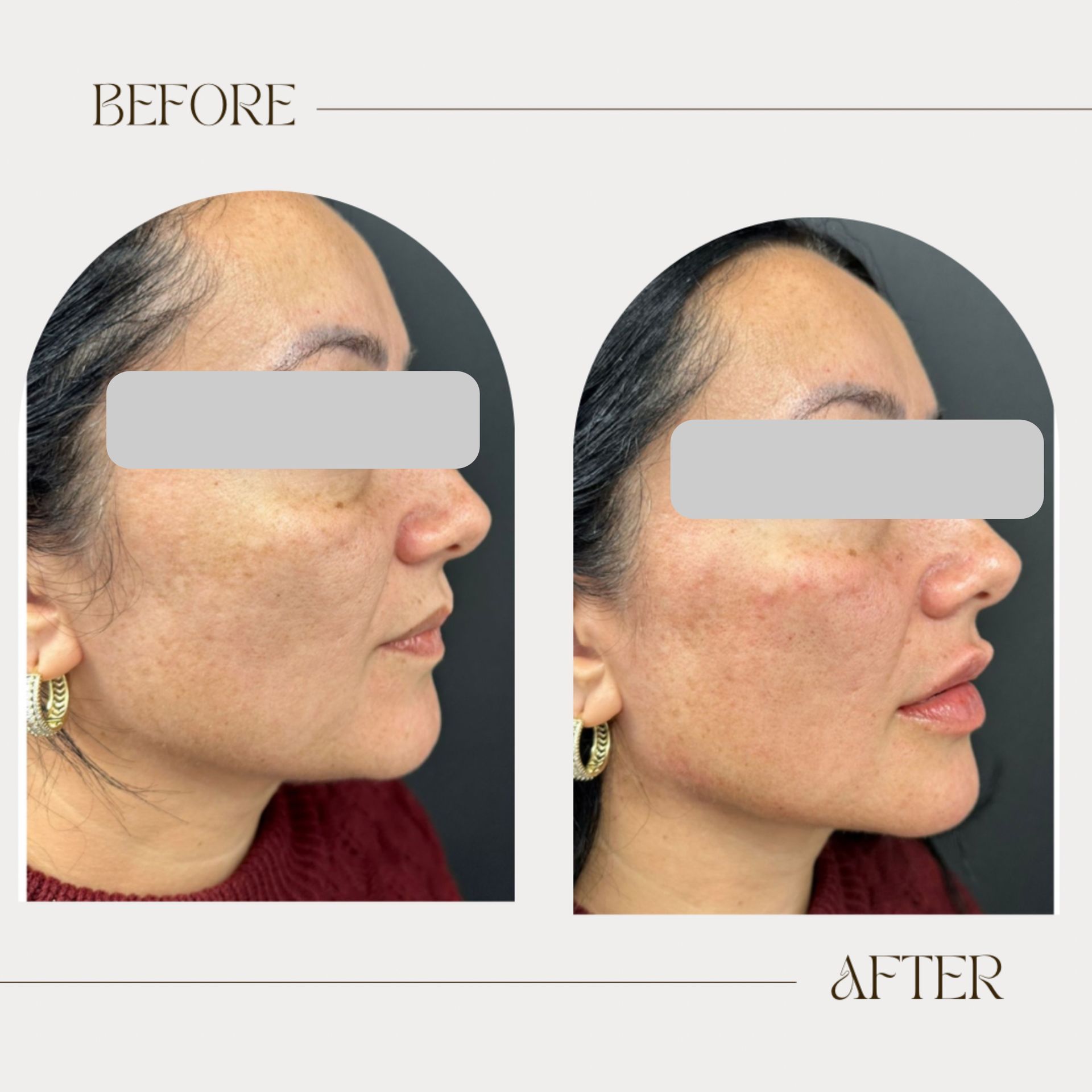 A before and after photo of a woman 's face