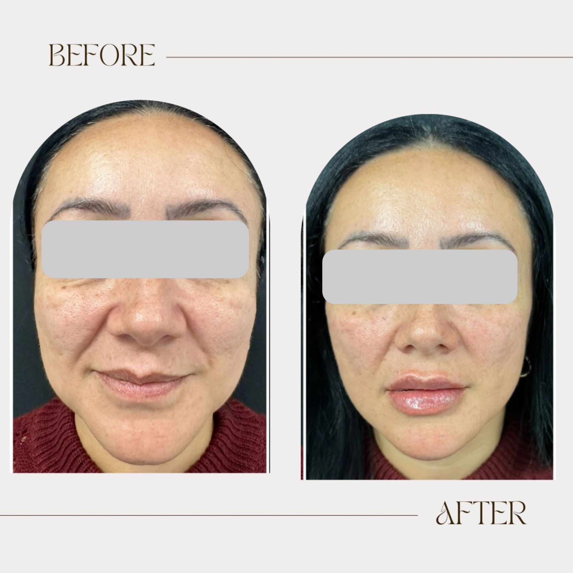 A before and after photo of a woman 's face.