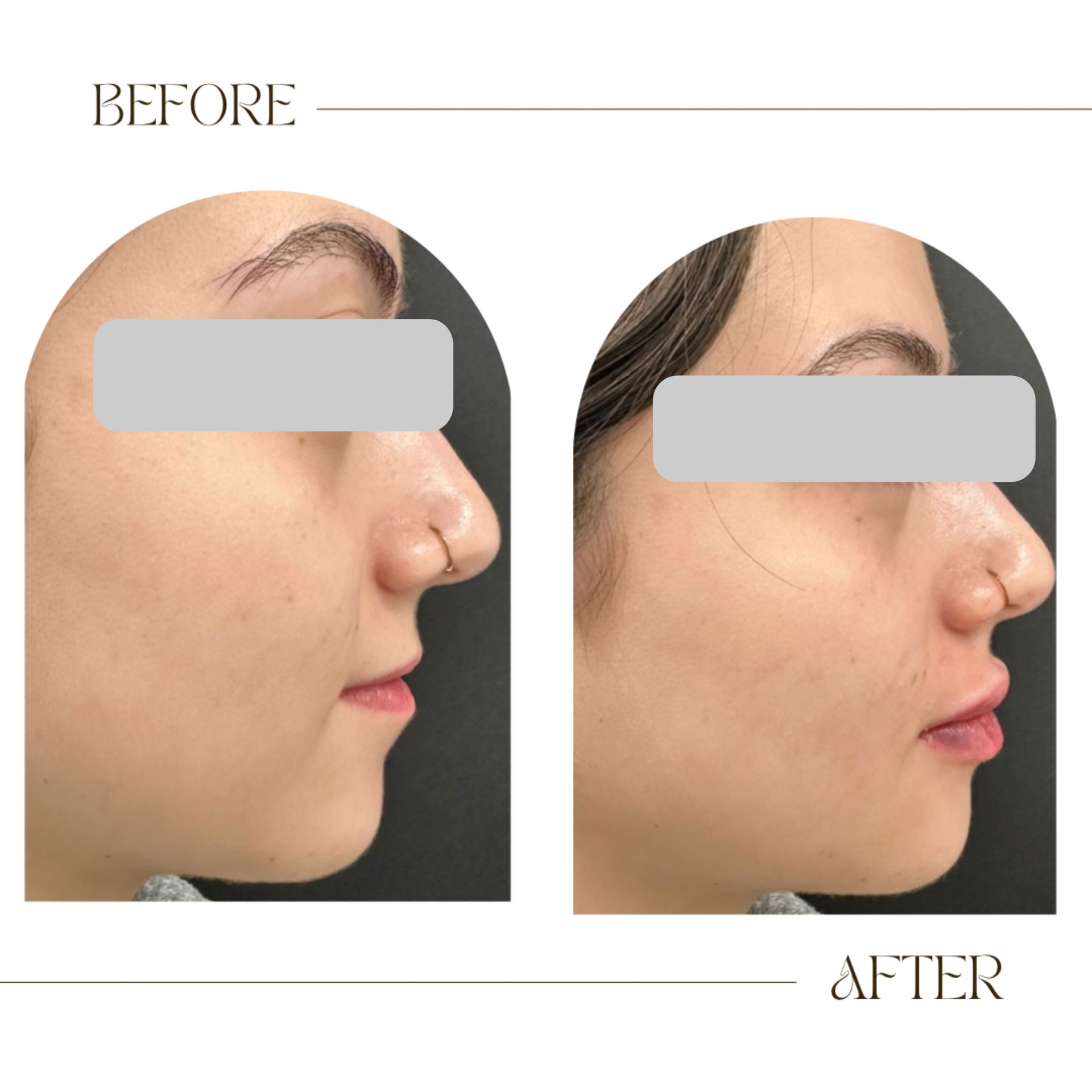 A before and after photo of a woman 's face.