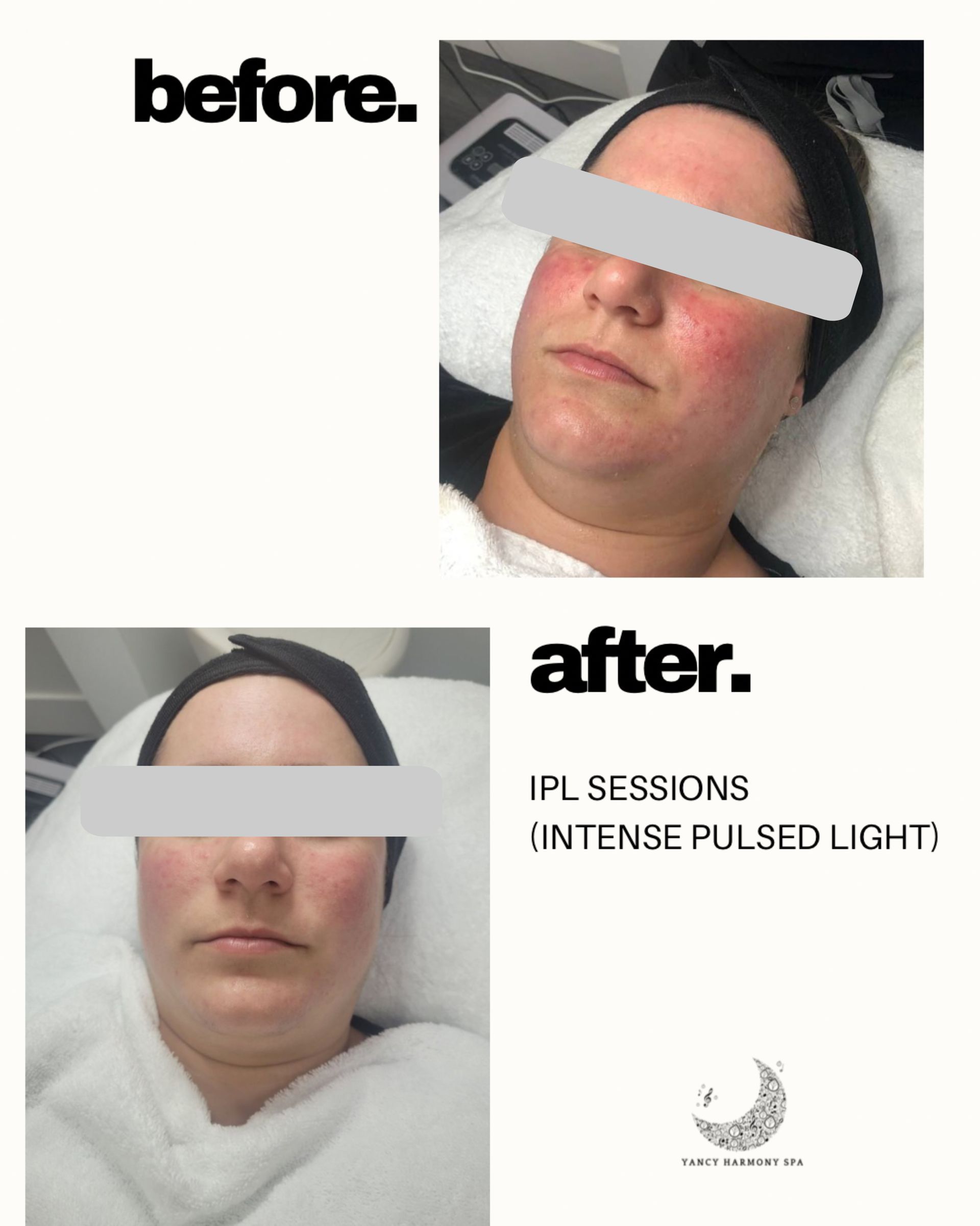 A before and after photo of a woman 's face