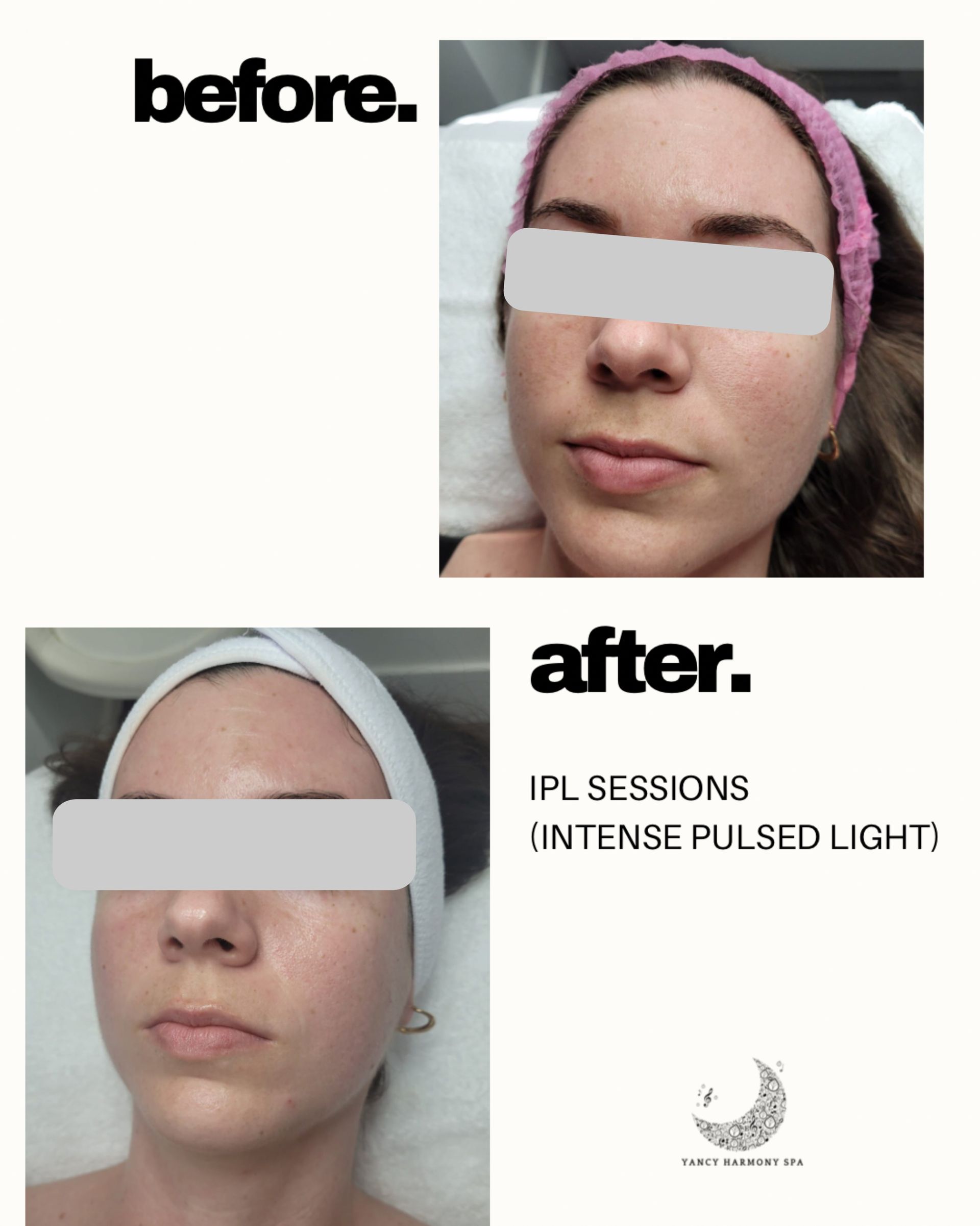 A before and after photo of a woman 's face