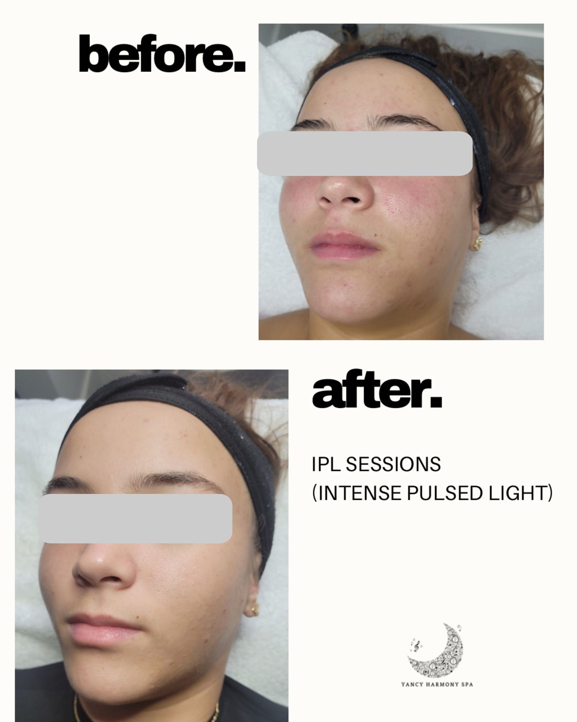 A before and after photo of a woman 's face