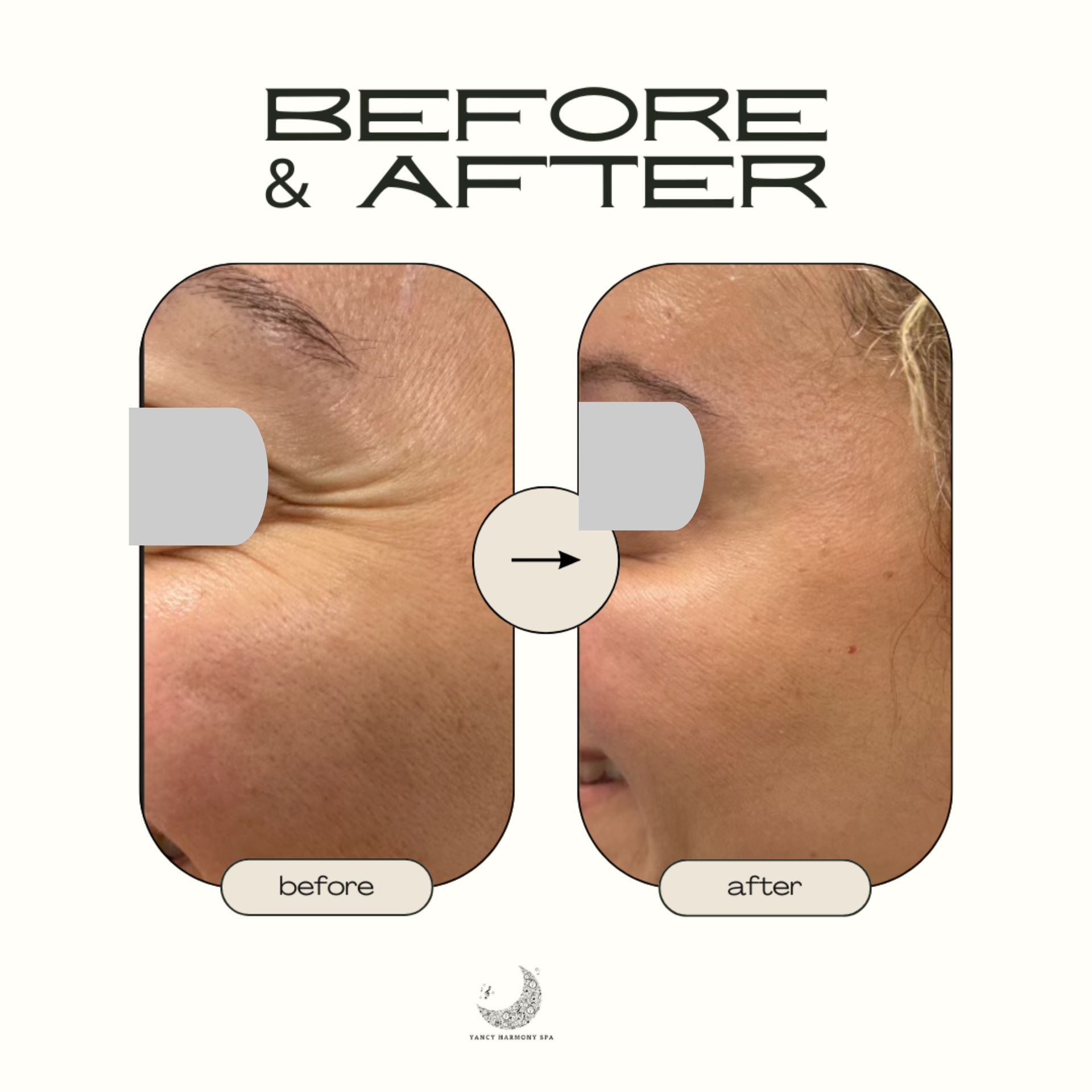 A before and after photo of a woman 's face