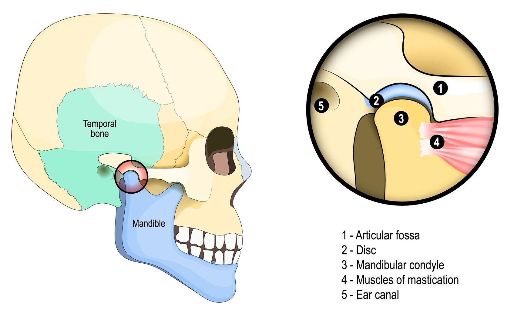 Diagram of the temporomandibular joint (TMJ). The jawbone (mandible) connects to the skull. 