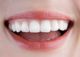 Dental practice - Romford, London - Oakland Dental Care - White teeth