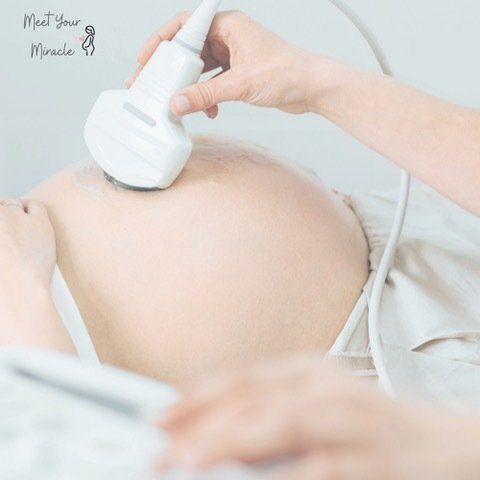 A pregnant woman is getting an ultrasound from a doctor