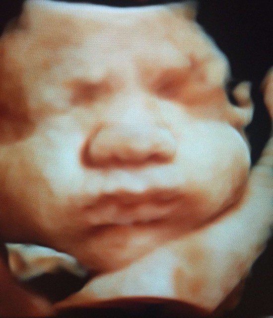A close up of a baby 's face with its eyes closed