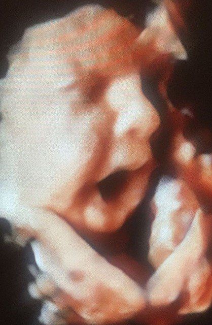 A close up of a baby 's face with its mouth open