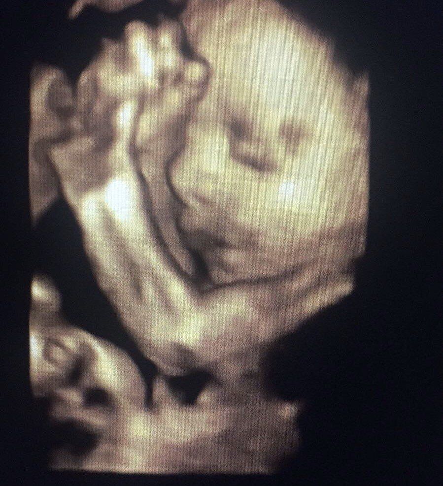 A black and white photo of a baby 's face