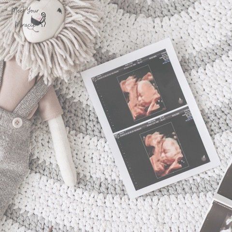 An ultrasound of a baby is on a blanket next to a stuffed lion