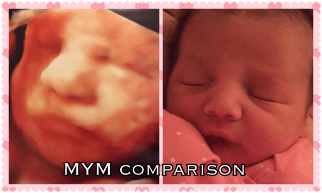 A picture of a baby in the womb and a picture of a baby sleeping