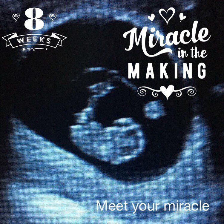 An ultrasound of a baby with the words 