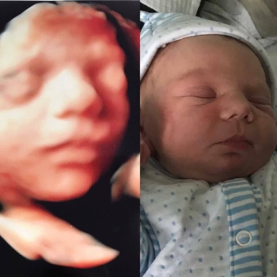 An ultrasound of a baby 's face next to a picture of a baby sleeping