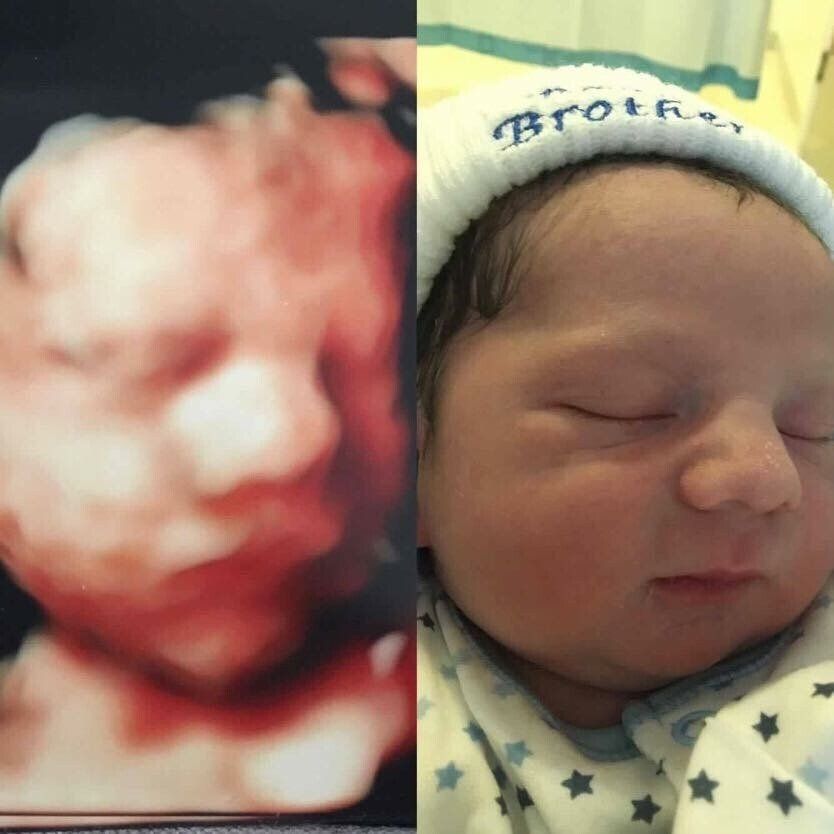 A baby is wearing a hat that says brother on it