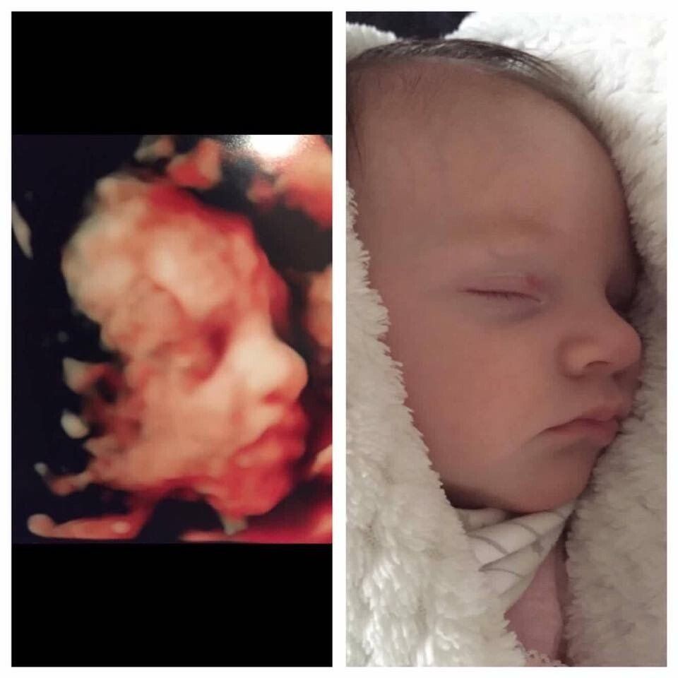 An ultrasound of a baby and a picture of a baby wrapped in a blanket