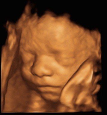 A close up of a baby 's face with a black background