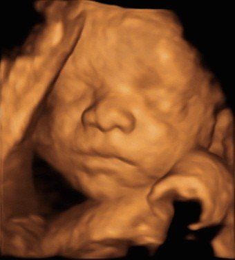 A close up of a baby 's face with its eyes closed