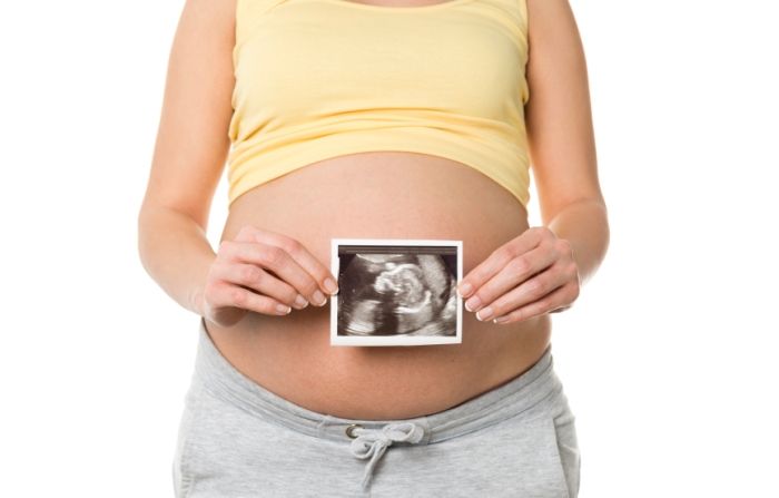 A stack of ultrasound images showing a baby in the womb